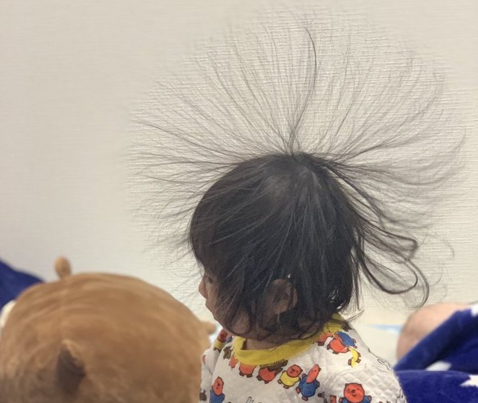 毛布でゴロゴロ 静電気パチパチ そして 一歳児の斬新なヘアスタイルに ウニの生まれ変わり たんぽぽのわたげみたい 全文表示 コラム Jタウンネット 東京都